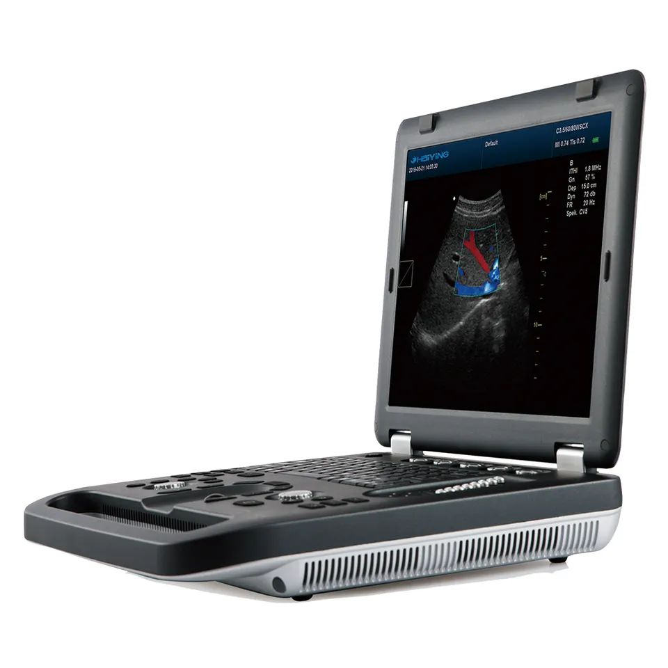 M10 Ultrasound machine